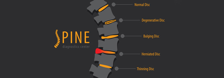 Chiropractic Flower Mound TX Spinal Decompression